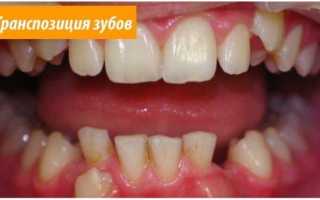 Почему зубы становятся подвижными