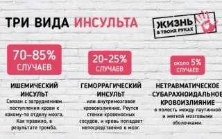 Профилактика инсульта: как избежать заболевания